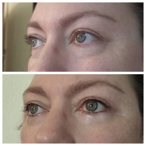 Eyeliner tattoo result
